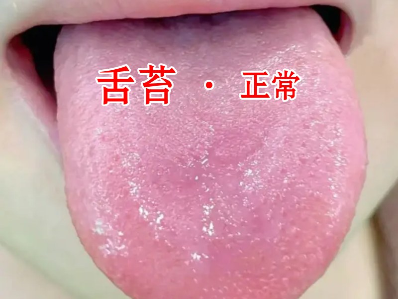 舌苔照片2